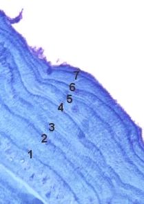 Aging Deer: Cementum annuli